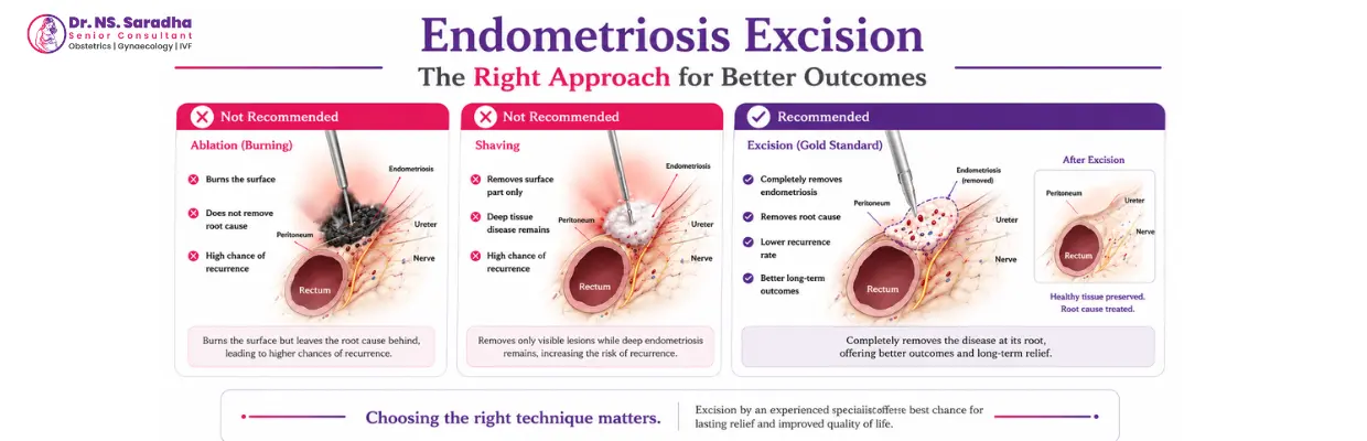 Laparoscopic Procedures