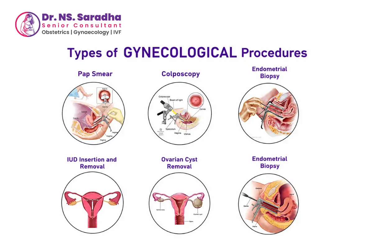 Minimally Invasive Surgery