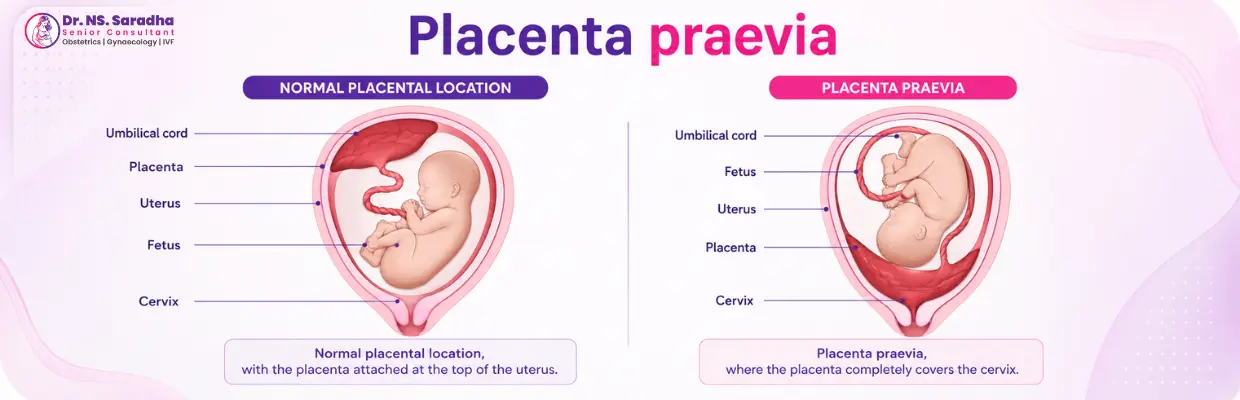 Pregnancy Related Conditions