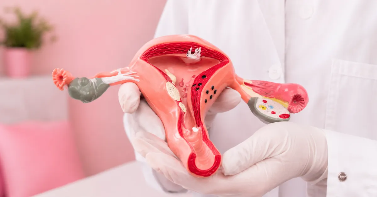 Structural Uterine Conditions